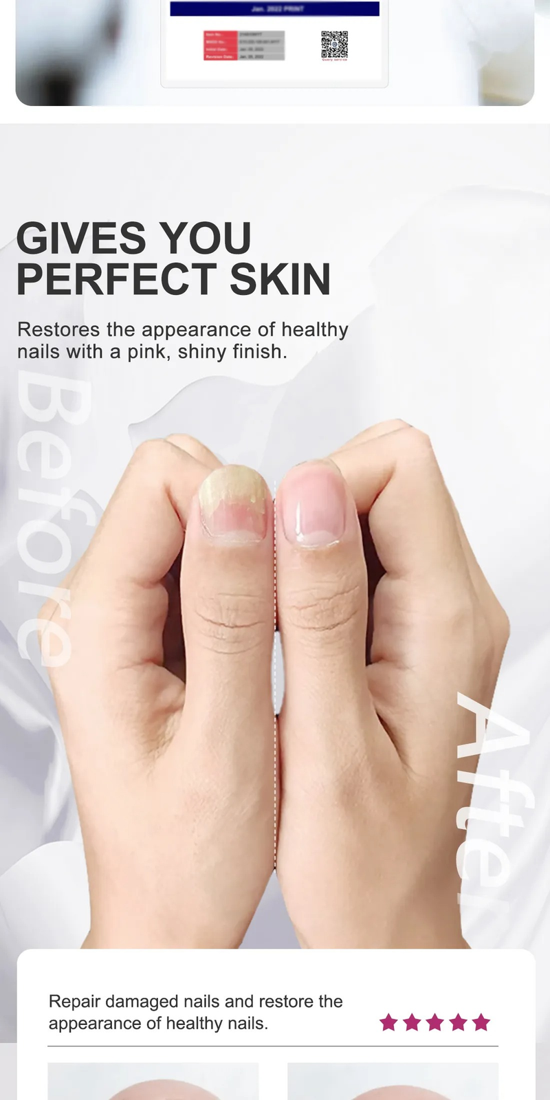 RtopR Ingwer-Nagellack, Nagelbehandlung, Pilz-Nagelreparatur, Raue Nagelreparatur, Förderung des Nagelwachstums, Anti-Pilz-Nagelinfektion_voghion.com