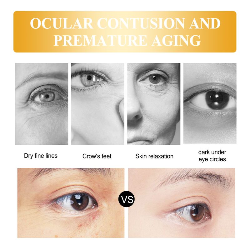 EELHOE Rice Serum Eye Cre Reduces Dark Circles, Bags, Wrinkles, Care For The Area, Moisturize And Anti Wrinkle Eye_voghion.com