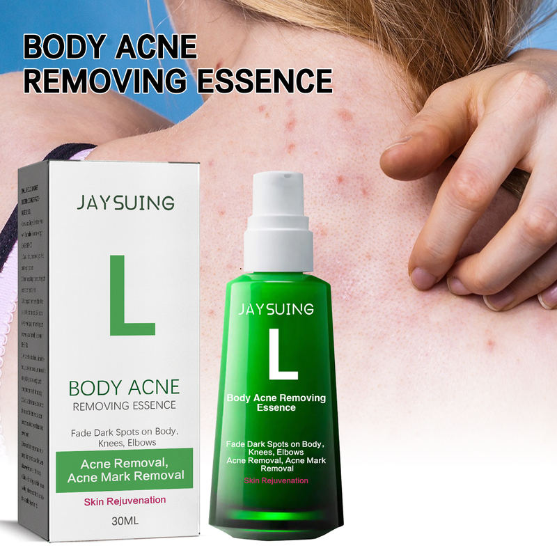 Jayswing Acne Removing&Whitening can lighten spots, acne marks, moisturize and whiten skin essence_voghion.com