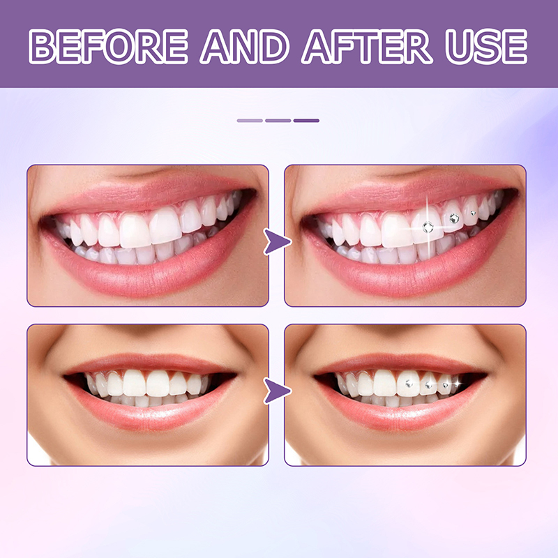 Gem Gue Tooth Denta Adhesive for Tooth Gems Diamond Kit Gue Teeth Crysta Jewery Sturdy Tooth Jewery Orthodontic s_voghion.com