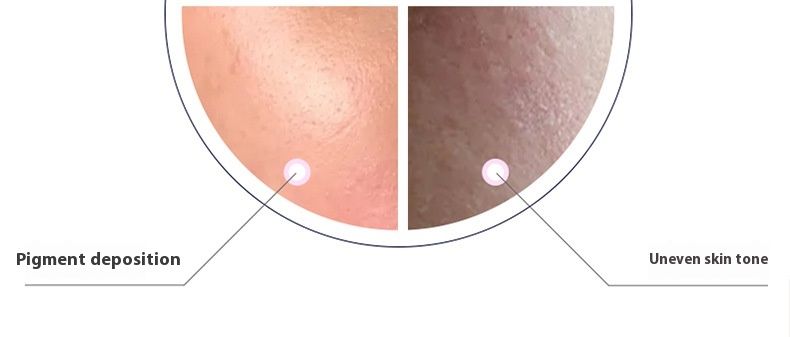 Etanaseerumi Kollageeniratkaisu Essence Original Solution Kosteuttava ja ohentava hoito_voghion.com