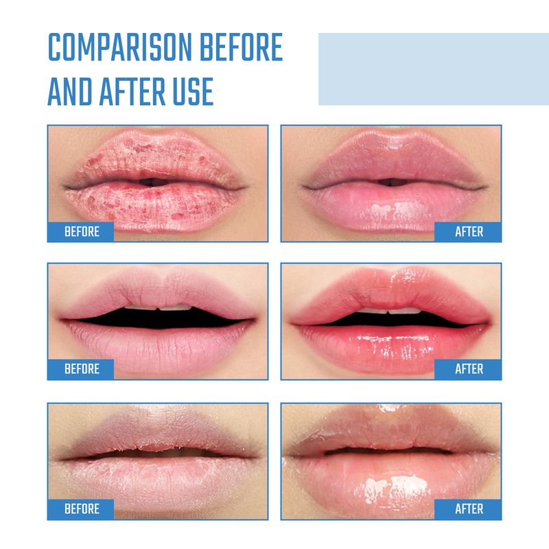 Hoygi Collagen Lip Mask Fade Lip Lines, Remove Dead Skin, Prevent Dry And Crack, Moisturize And Care Lip Mask_voghion.com