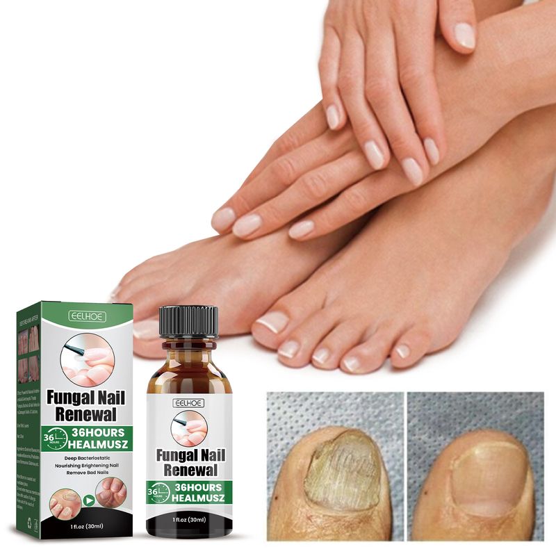 EELHOE Grey Repair Nährende Hand-Fuß-Nagelpflegeflüssigkeit zum Entfernen grauer, aufhellender Nägel und feuchtigkeitsspendender Nägel_voghion.com