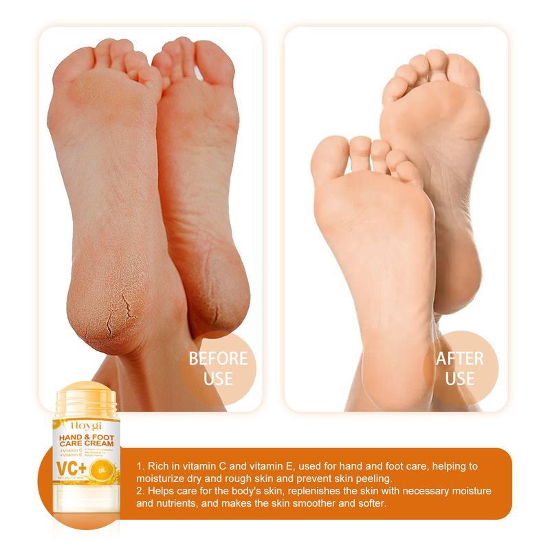 Hoygi Nourishing Hand Foot Care Cream verhënnert Rëssbildung vun den Hänn a Féiss, Reparatur vun doudegen Haut, Hydratatioun an Feuchtigkeit vun der dréchener Haut_voghion.com