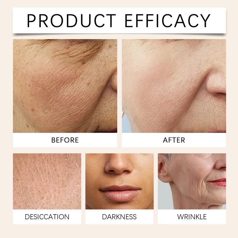 JAYSUING Turmeric Vitamin C Face Cream Gently Cares, Hydrates, Nourishes, Moisturizes, Tightens And Tender Skin_voghion.com