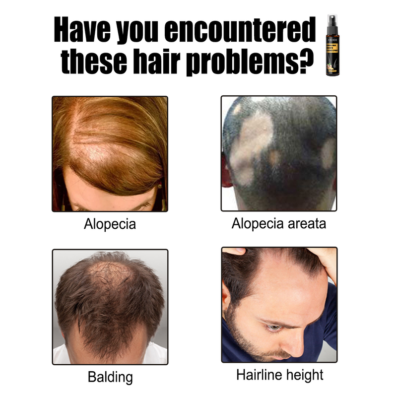 EELHOE Herbal Roller Nourishing Repairing Root Scalp Anti dropping and Hair Firming essence_voghion.com