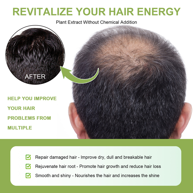 Rosemary Dense Moisturizes Roots, Increases Elasticity, Restores Gloss, and Prevents Hair Loss spray_voghion.com