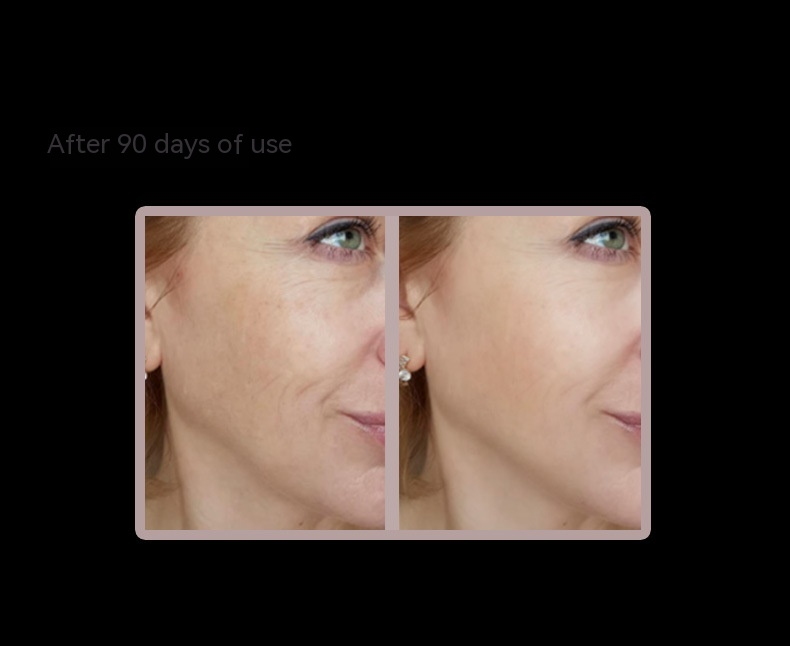 Direct home machine for chin, V-face, colored light, tenant skin, lifting mass, EMS remote control beauty and social_voghion.com