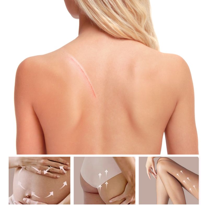 Emulsion KÖRPERÖL Langanhaltendes, feuchtigkeitsspeicherndes, geschmeidiges, feuchtigkeitsspendendes, pralles, strahlendes, straffendes und pflegendes Körperöl_voghion.com