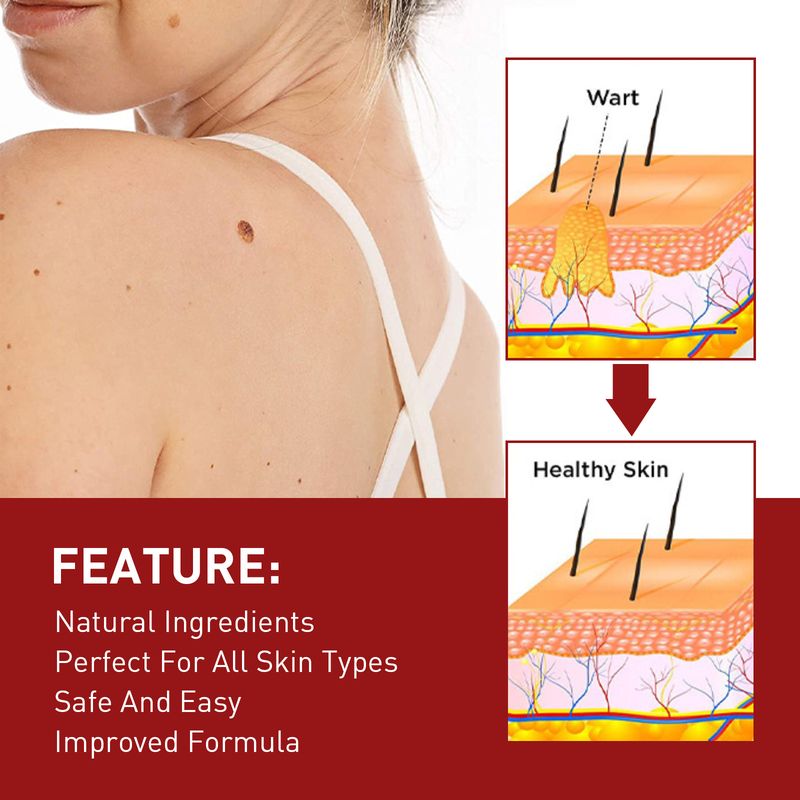 2025 Αντι-ελιές για βαθύ καθαρισμό του δέρματος, εξάλειψη κονδυλωμάτων, αφαλάτωση μαύρων ελιών, επανόρθωση και λείανση_voghion.com