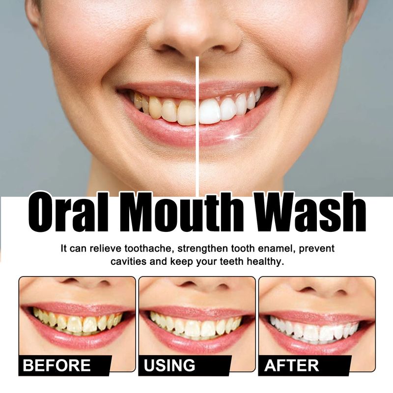 Oralhoe Oral Cleansing Mousse Zahnreinigung Repariert gelbe Flecken, hellt die Zähne auf und sorgt für einen erfrischenden Atem_voghion.com