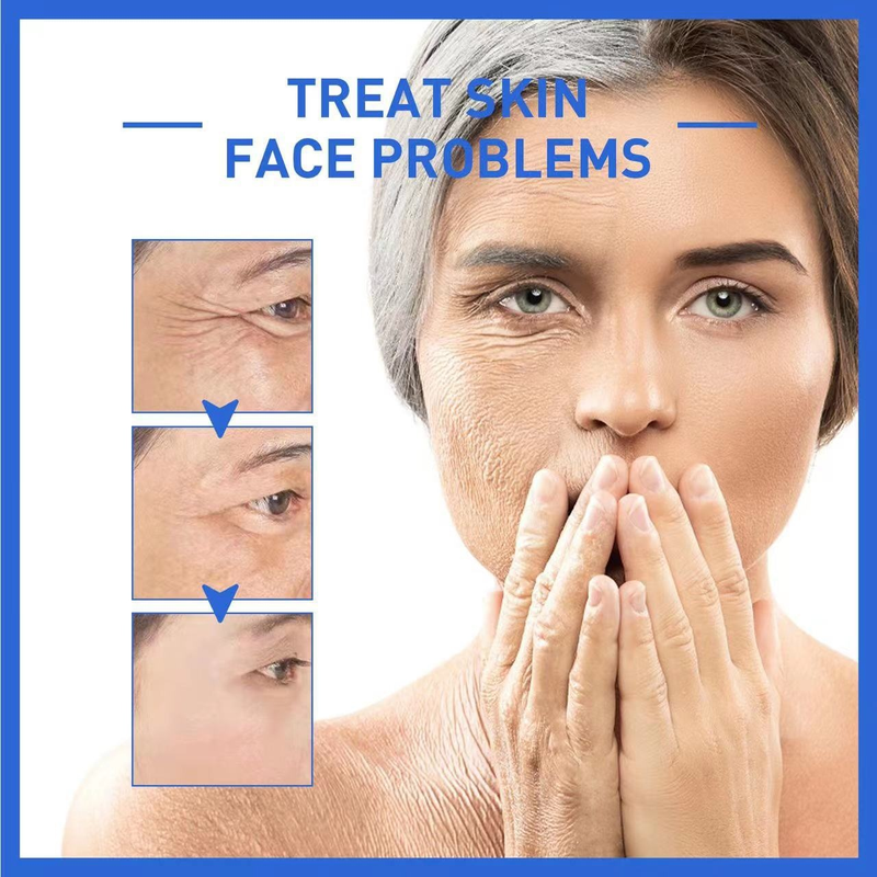 SOL LORA Anti Wrinkle Original Liquid can light fine lines black spots, moisture, tender skin, and prevent aging session_voghion.com