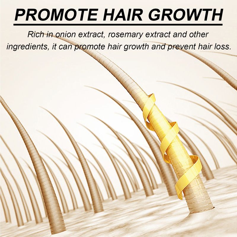 Ouhoe Onion Biotin Rosemary Shampoo Set Nourishes Roots, Scalp Gloss, Hair Care And Cleaning_voghion.com