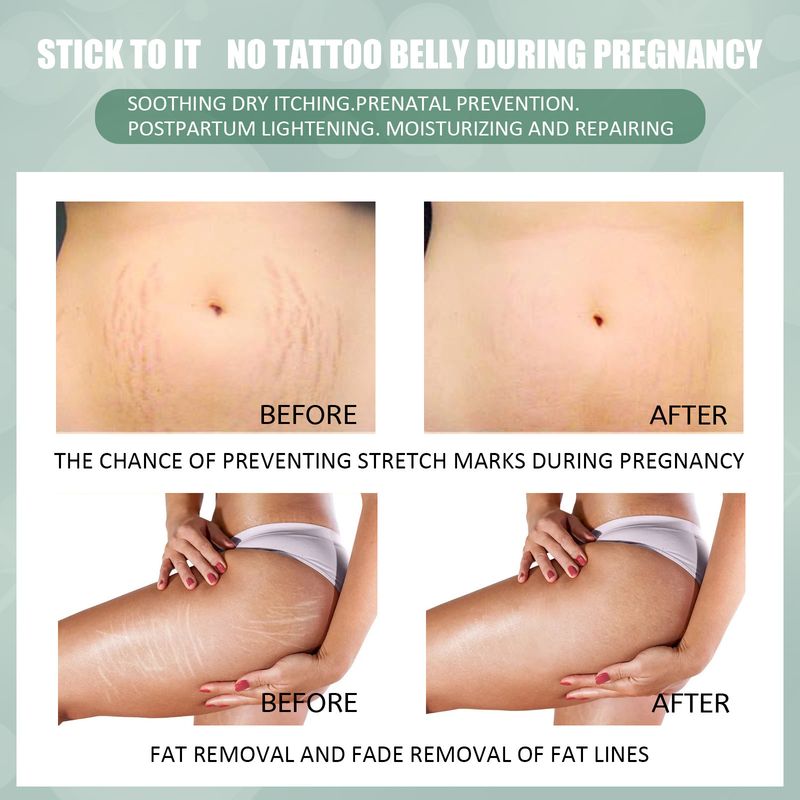 Skin Repair Cream er en daglig skånsom fuktighetskrem for kroppen, brukt til å reparere og forbedre hudkvaliteten_voghion.com