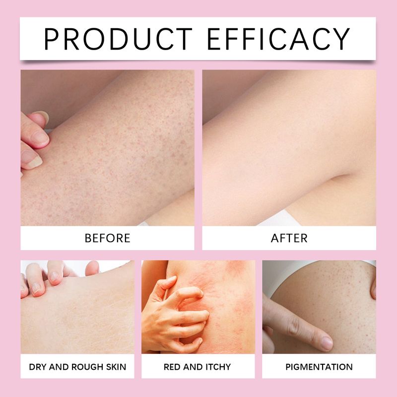 EELHOE Sakura Body Skin Care Kit, Zachte reiniging, hydraterend, hydraterend, voedende huidgeur_voghion.com