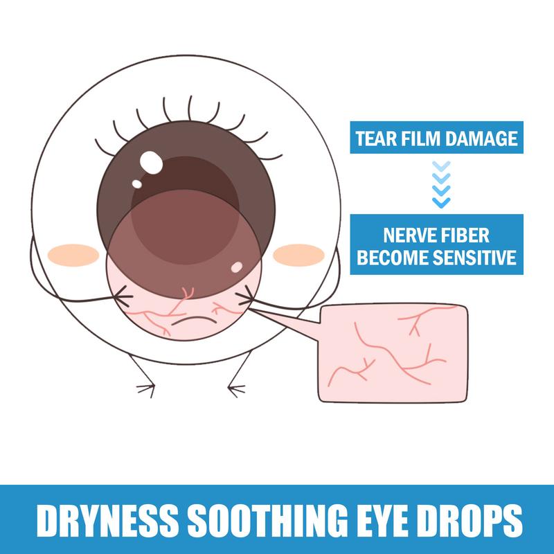 South Moon Dry Soothing Eye Drops Relieve Eye Fatigue, Dry Eyes, Red Eyes and Blurred Vision Eye Care Solution_voghion.com