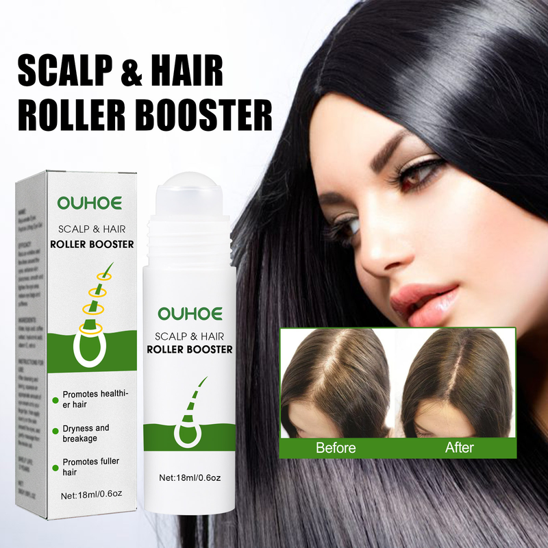 OUHOE Flüssige, nährende und reparierende Haarwurzeln, dicke Linie, Anti-Tropfen und fester Haarpflegeball_voghion.com