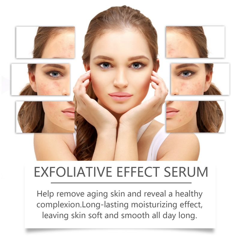 Hoygi Facial Essence, Moisturizing, Brightening And Moisturizing Facial Skin Exfoliating Gentle Cleansing Repair Essence_voghion.com