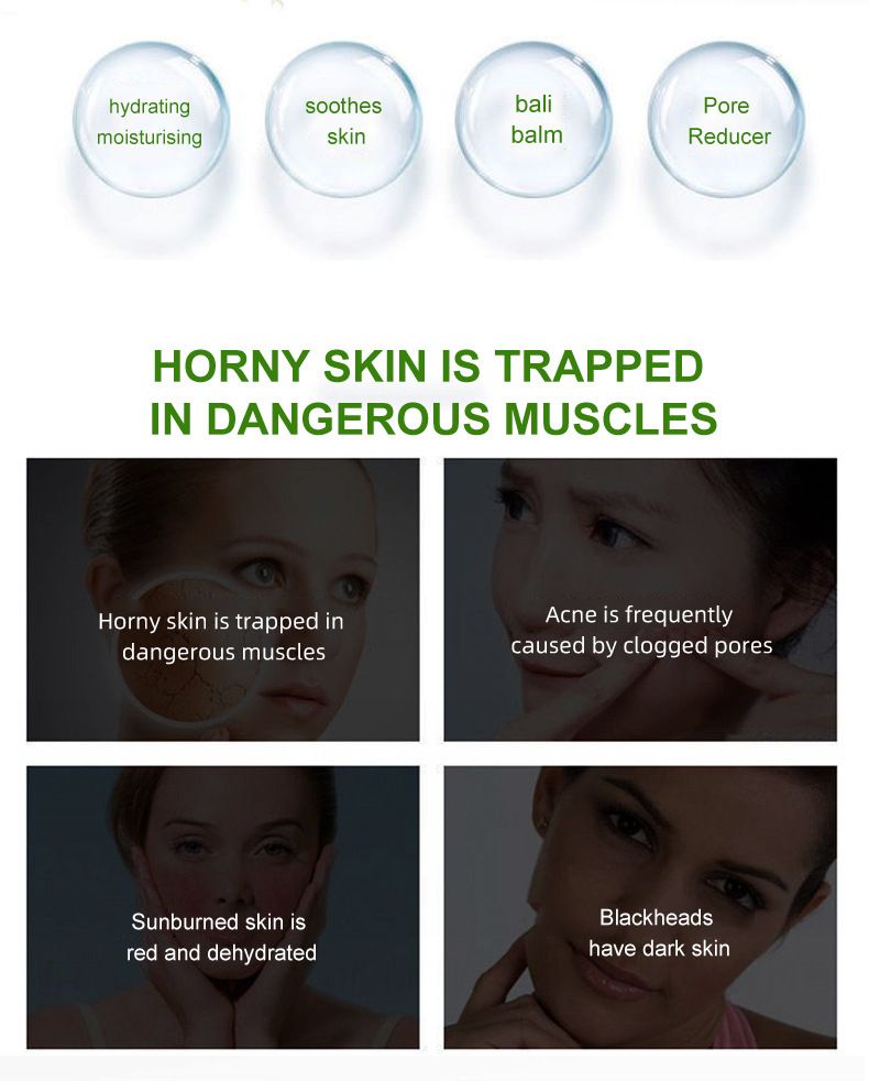 Gel di Aloe Vera SIMU - Idratante, nutriente e ammorbidente per la cura della pelle secca_voghion.com