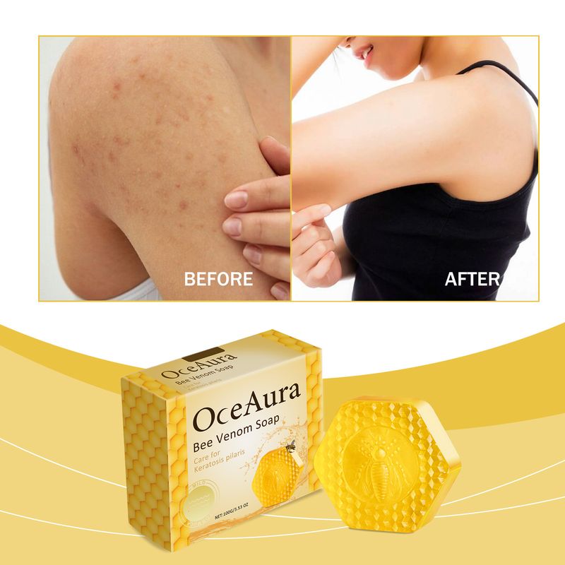 Oceaura Bee Venom Soap For Deep Body Cleansing, Moisturizing, Brightening And Improving Skin And Bathing Body Soap_voghion.com