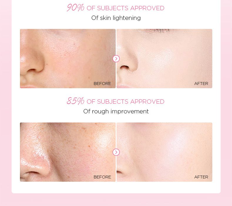 Laico Japon Sakura Yüz Peelingi 100g Keratin Temizleyici Nemlendirici_voghion.com
