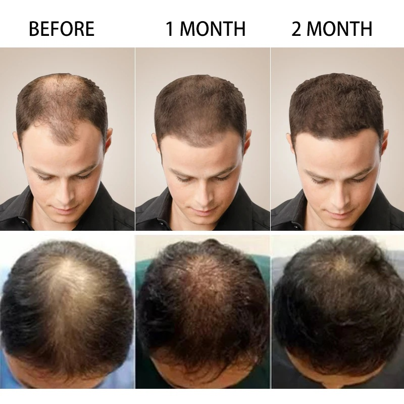 PURC Hair Care spray Repairs Dry, Broken, Manic, Soft, Fluffy, Glossy Ginger session_voghion.com