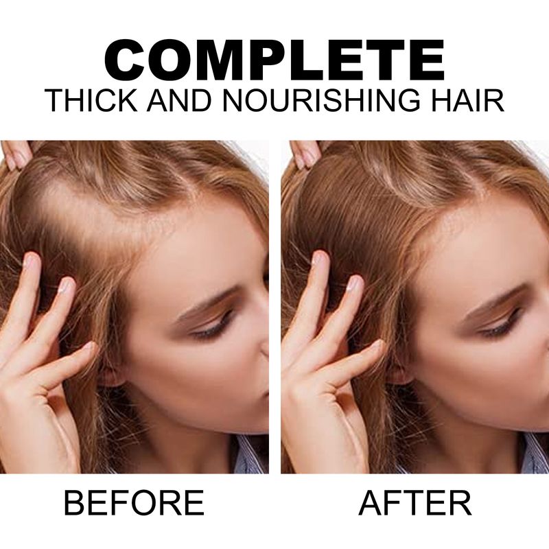 Spray pour la croissance des cheveux, réparation des dommages, réduction de la perte, restauration du cuir chevelu, traitement hydratant efficace, prévention de la calvitie, soins pour cheveux longs, huiles_voghion.com