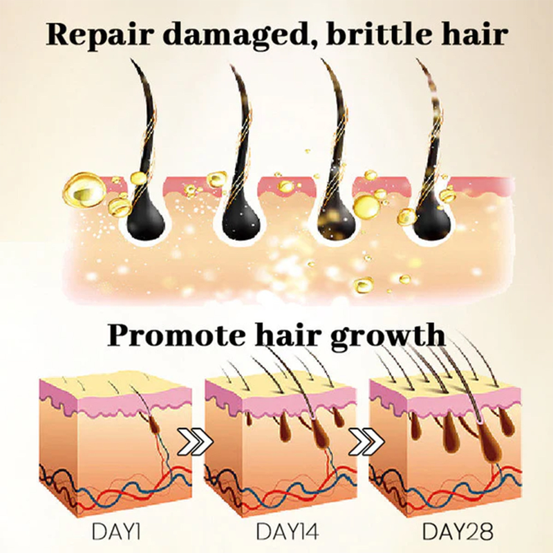 OUHOE ženšenni massaaž Niisutav peanahk, tugevad juuksed, pinguldav, väljalangemisvastane hooldus, tihe juukseessents_voghion.com