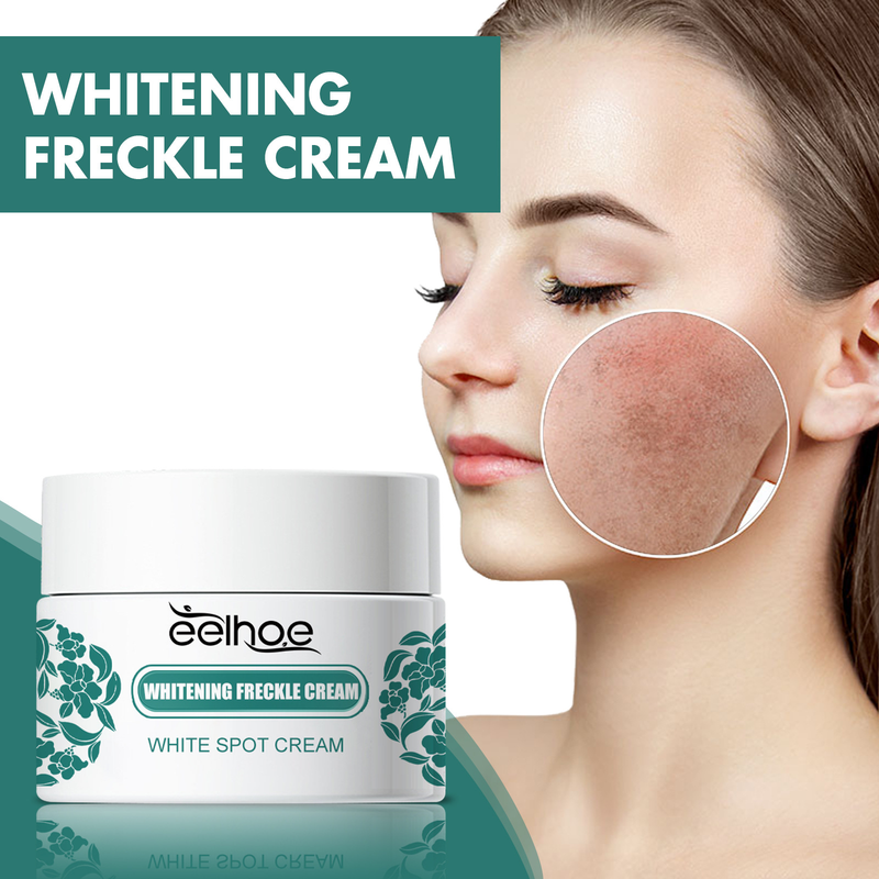 Spot Beautiful Whitening&Attenuating Cream Whitening&Moisturizing Skin Whitening&Brightening Anti aging face cream_voghion.com