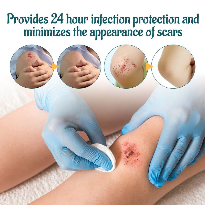 Ximonth Repair Relieving Scratches And Traumas, Fading Scars, Moisturizing Skin Care Cream_voghion.com