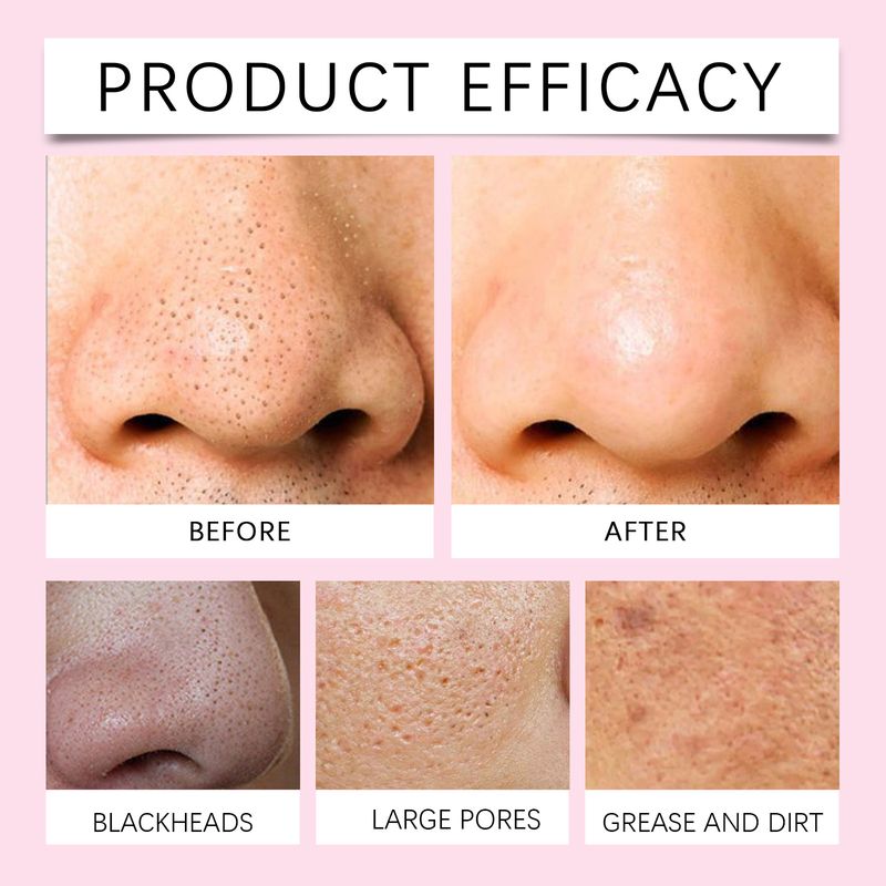 HOYGI Niacinamide Deep Cleansing Milk Poren sanft, entfernt Akne, reinigt das Gesicht mit erfrischender Pflege, spendet Feuchtigkeit und_voghion.com