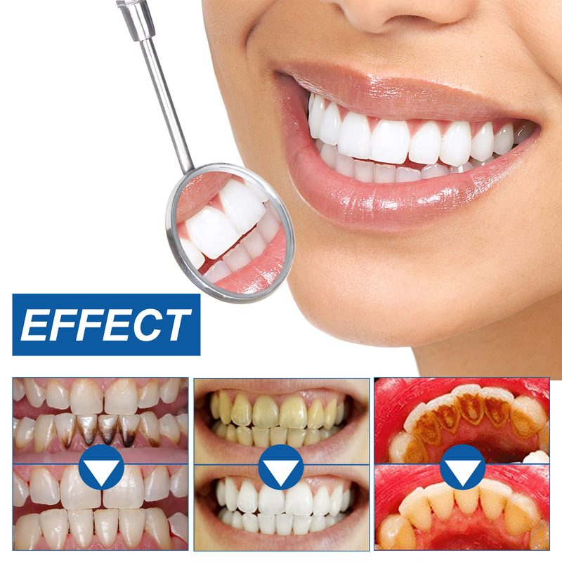 Schönes Zahnaufhellungspulver, reinigt orale Zahnflecken, gelbe Zahnflecken, Zahnfleischpflege, Aufhellung und Bea_voghion.com