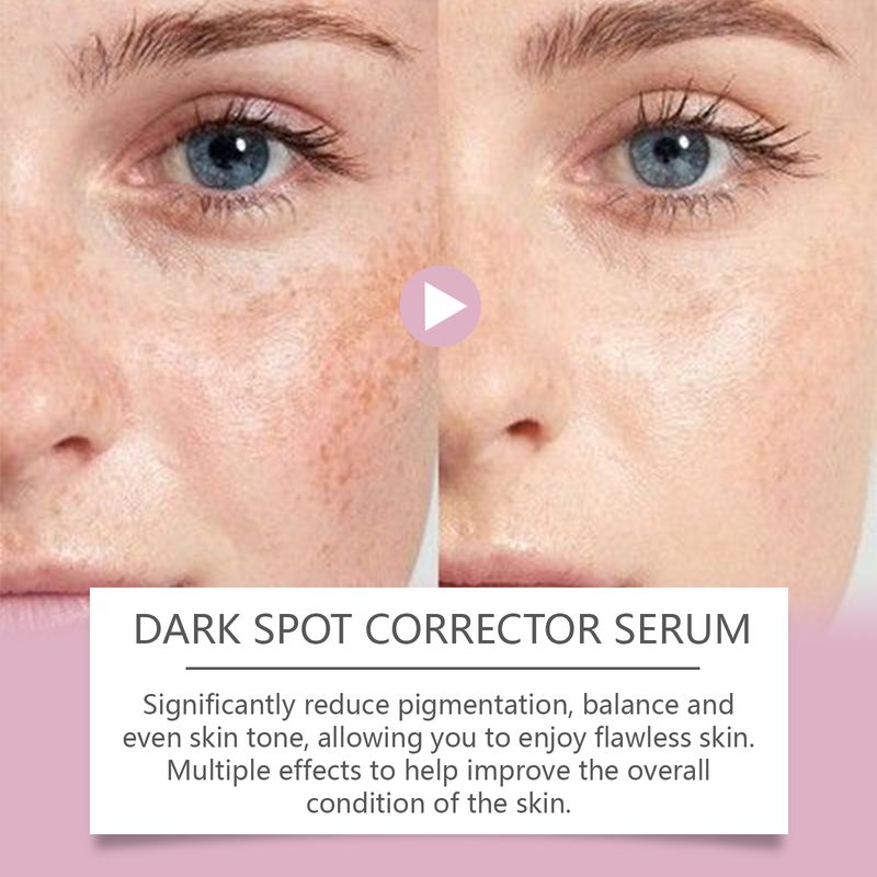 Hoygi Patch Repair Cream_voghion.com