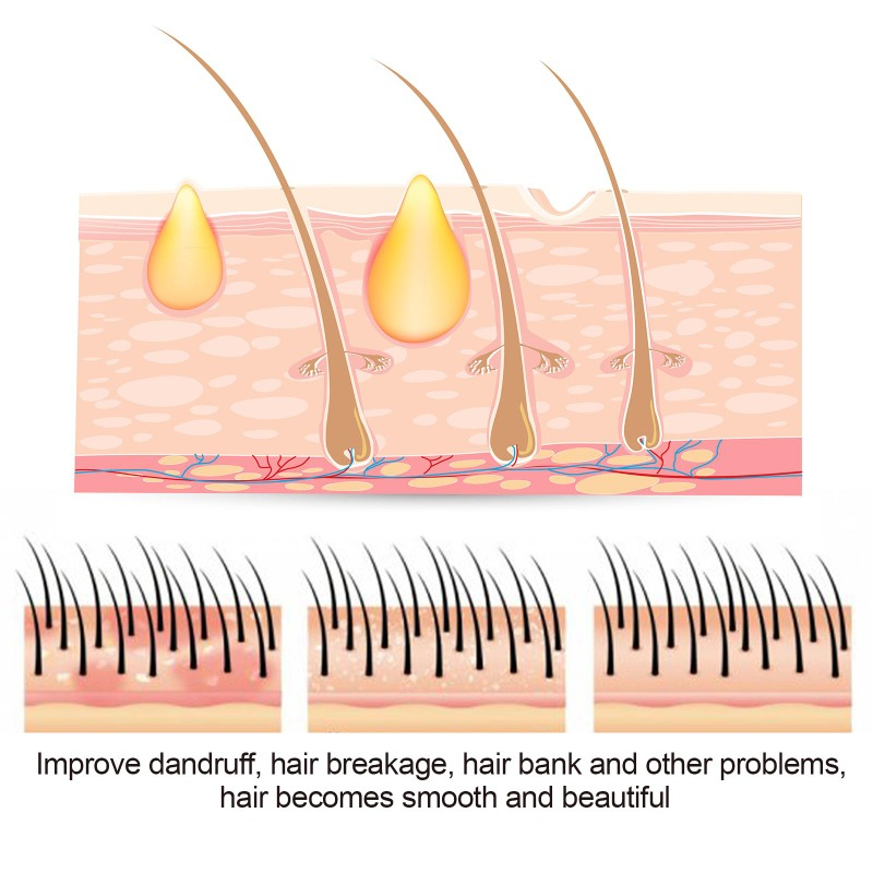 Sulfur Shampoo 50g Remove Lice Mites Dandruff Itching Oil Cleaning Scalp Deep Hair Antipruritic Follicles Cleaning_voghion.com