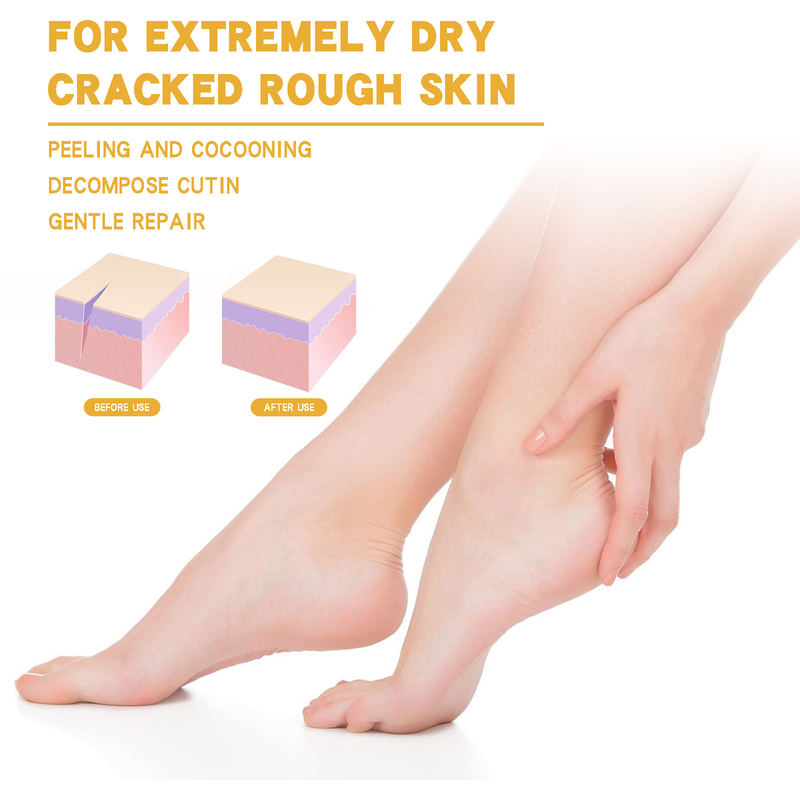 and Beautiful Moisturizing chapping Cream for Foot Care, Heel Moisturizing and Anti Dry Cracking, Peeling and chapping_voghion.com