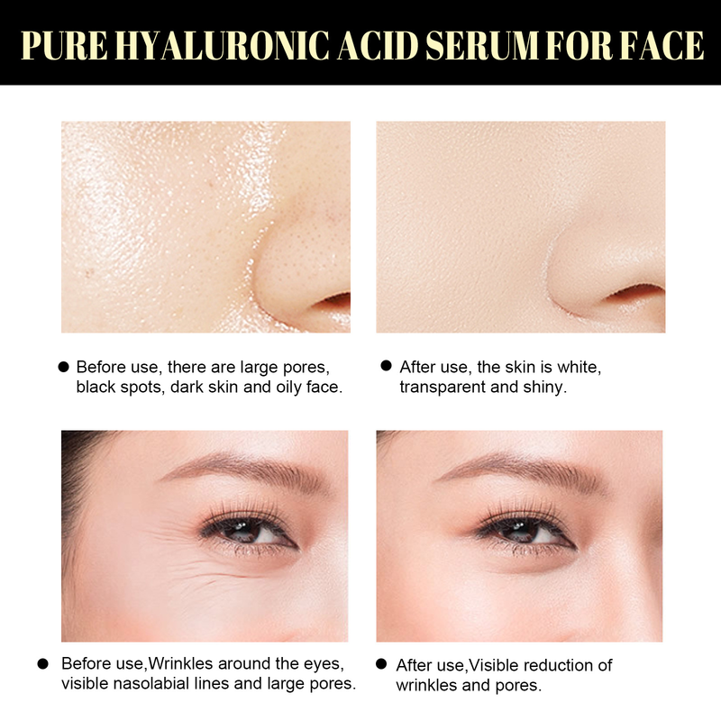 Protein Lifting Thread Kit Face Lift Plump Silk Protein Line Carving Anti Aging Firming Fade Fine Wrinkle Serum Skin Care Female_voghion.com