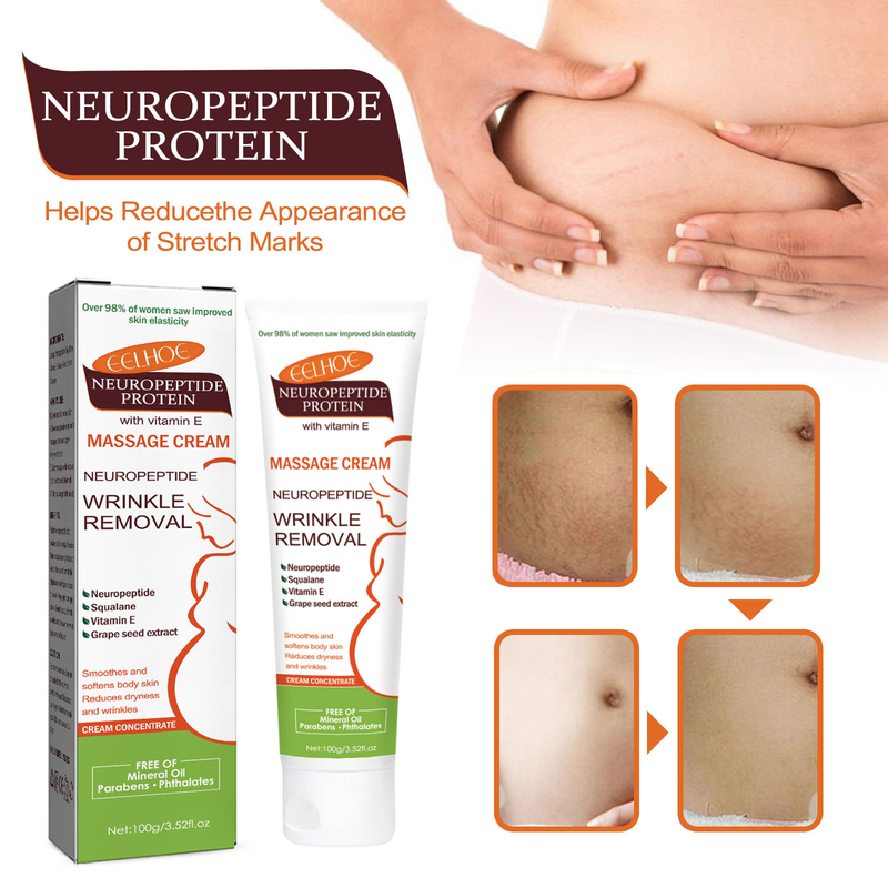 EELHOE Neuropeptid-Protein-Narbenlinderung, Schwangerschaft, Körperlinienpflege, Massagecreme für glatte Haut_voghion.com