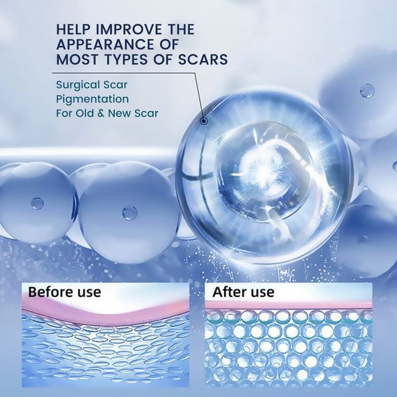 Crema Sumifun Lavanda Cicatrici Gel TiktokK10202_voghion.com