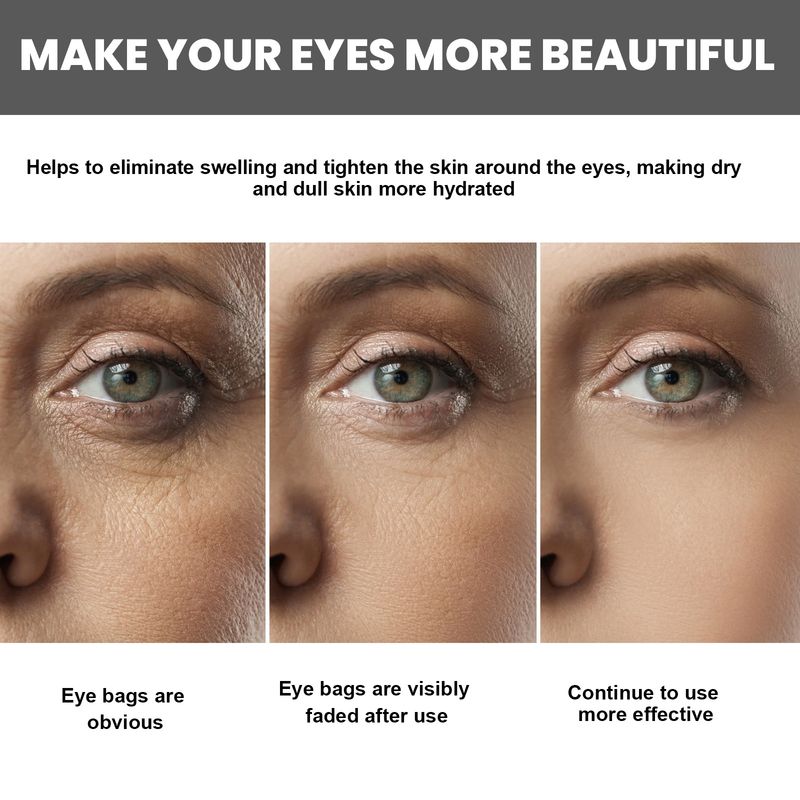 EELHOE Collagen Hyaluronic Acid Massager Softens Skin Around The Eyes, Lightens Fine Lines, And Care Eye Cream_voghion.com