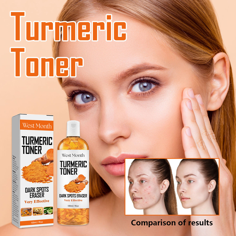 West&Month Black Turmeric Erfrischendes, tiefenwirksam hydratisierendes, straffendes, feuchtigkeitsspendendes und feuchtigkeitsspendendes Gesichtswasser_voghion.com