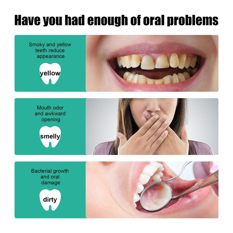 Mousse detergente Rinfresca l'alito, Pulisce in profondità lo sporco dei denti, Dentifricio gengivale, Cura l'igiene orale_voghion.com