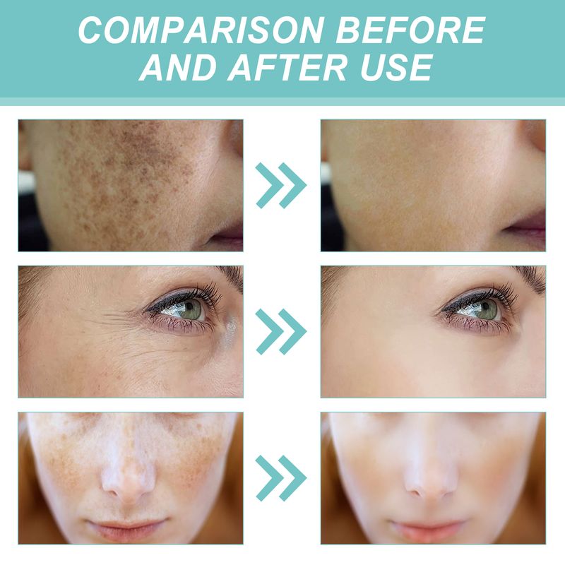 EELHOE Face Cream Moisturizes, Moisturizes, Brightening, Tenderizes, And Smooths Skin With Skin Care Essence Cream_voghion.com
