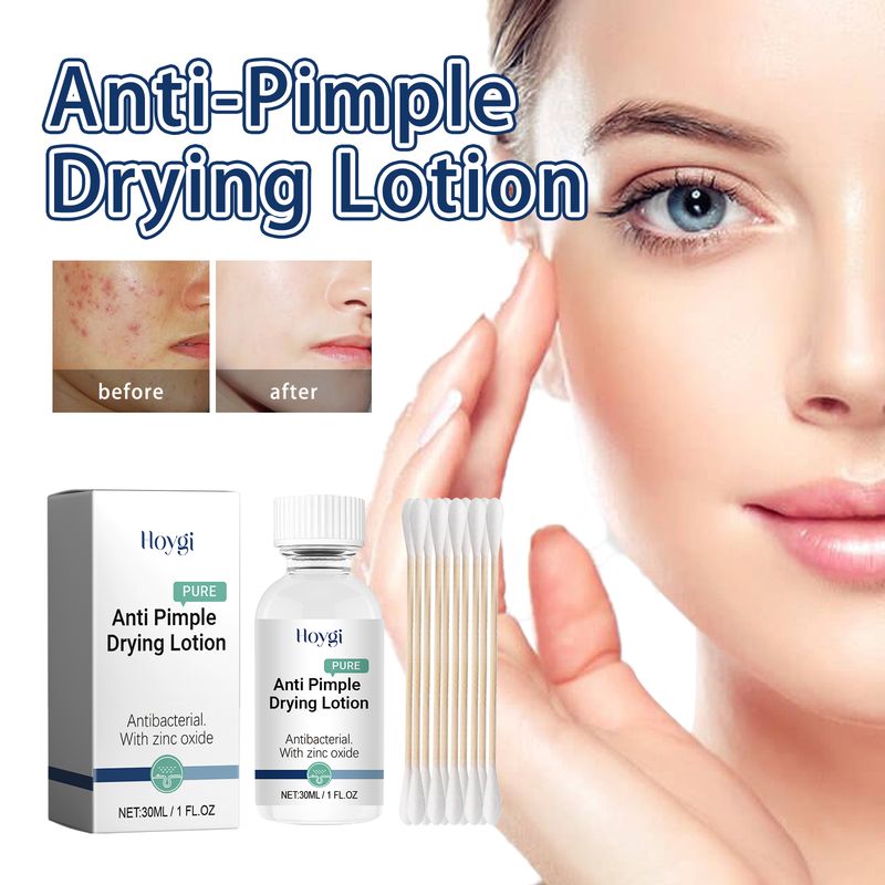 Hoygi Anti-Pimple Drying Lotion, Facial Cleansing And Repair Lighten Acne Marks And Pits, Close Your Mouth And Mild Skin Cream_voghion.com