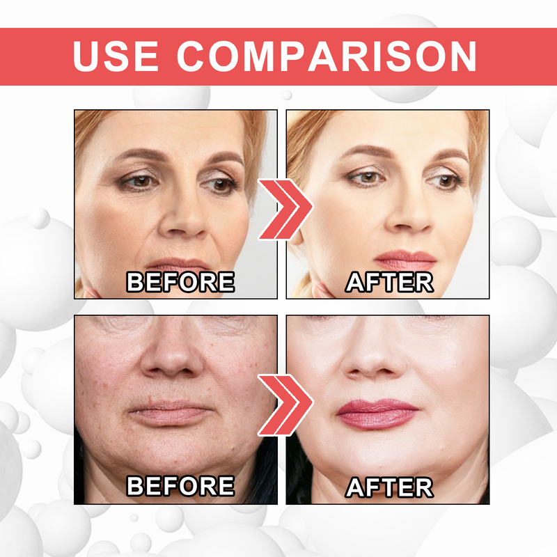 EELHOE Collagen Boost Anti Aging Serum Anti-Wrinkle Voletas Collagen Boost_voghion.com