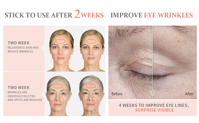 Estimulador Facial eléctrico Gua Sha 4 en 1, herramientas de raspado Facial con vibraciones calentadas, antiarrugas, doble mentón, moda facial_voghion.com