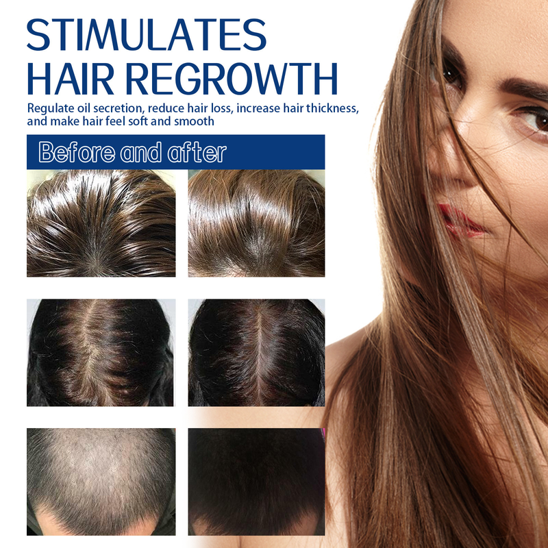 EELHOE Crema Detergente Scrub per Capelli per la forfora del cuoio capelluto, allevia il prurito, soffice, idratante, capelli densi, fissazione dei capelli,_voghion.com