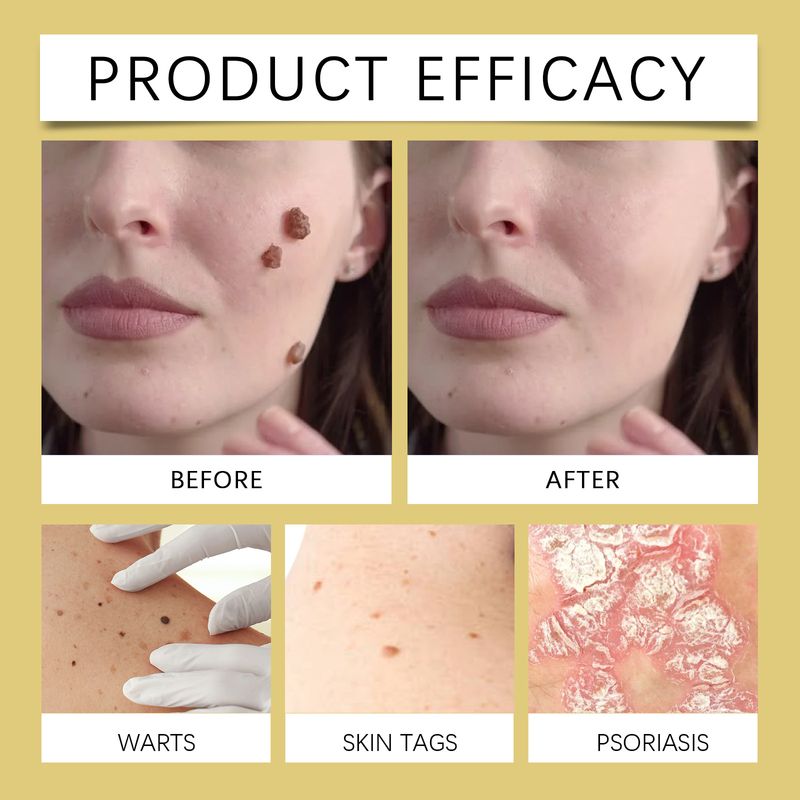 OUHOE Moisturizing Nourishing For Dry Gentle Massage Application Skin Care Cream_voghion.com