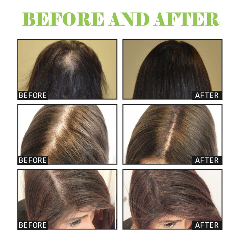 South Moon Ingwer-Pflegeshampoo, Kopfhautreinigung, dickes Haar, Anti-Fall, nährendes Haarwurzel-Stärkungsshampoo_voghion.com