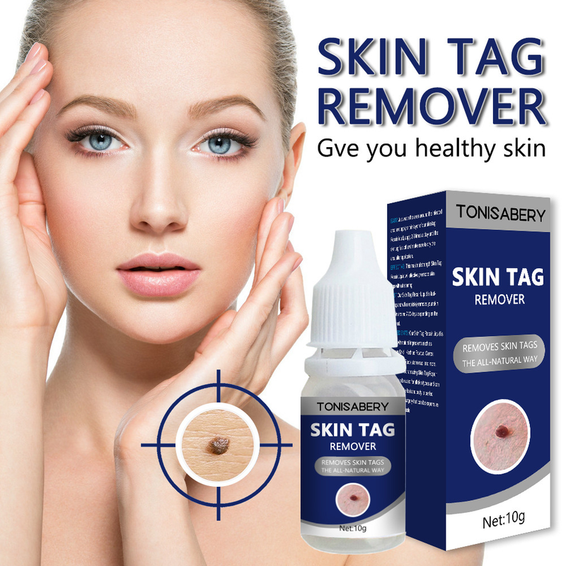 New Skin Tag Remove Wart Treatment_voghion.com