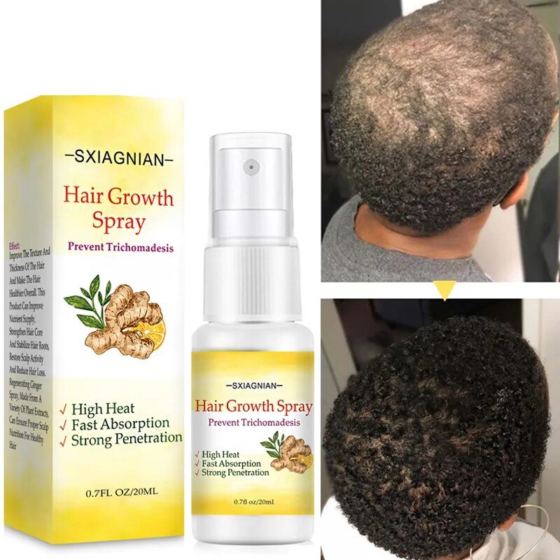 Ginger Fast Hair Growth Serum Spray Regrowth Essence Oil Hiustenlähtöä estävät tuotteet ehkäisevät kaljuuntumista Päänahan hoito Kauneus terveys_voghion.com